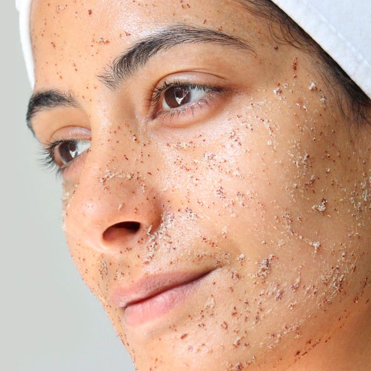 Peeling de fenol: o que é, antes e depois, riscos e cuidados